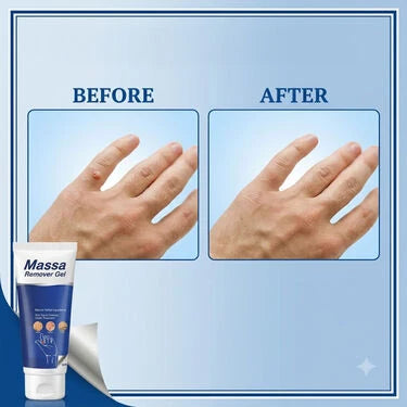 š„ ClearMassa Gel (BCMR) ā 100g (1 Pack)