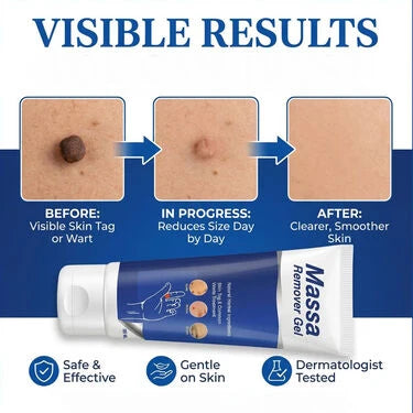 🔥 ClearMassa Gel (BCMR) – 100g (1 Pack)