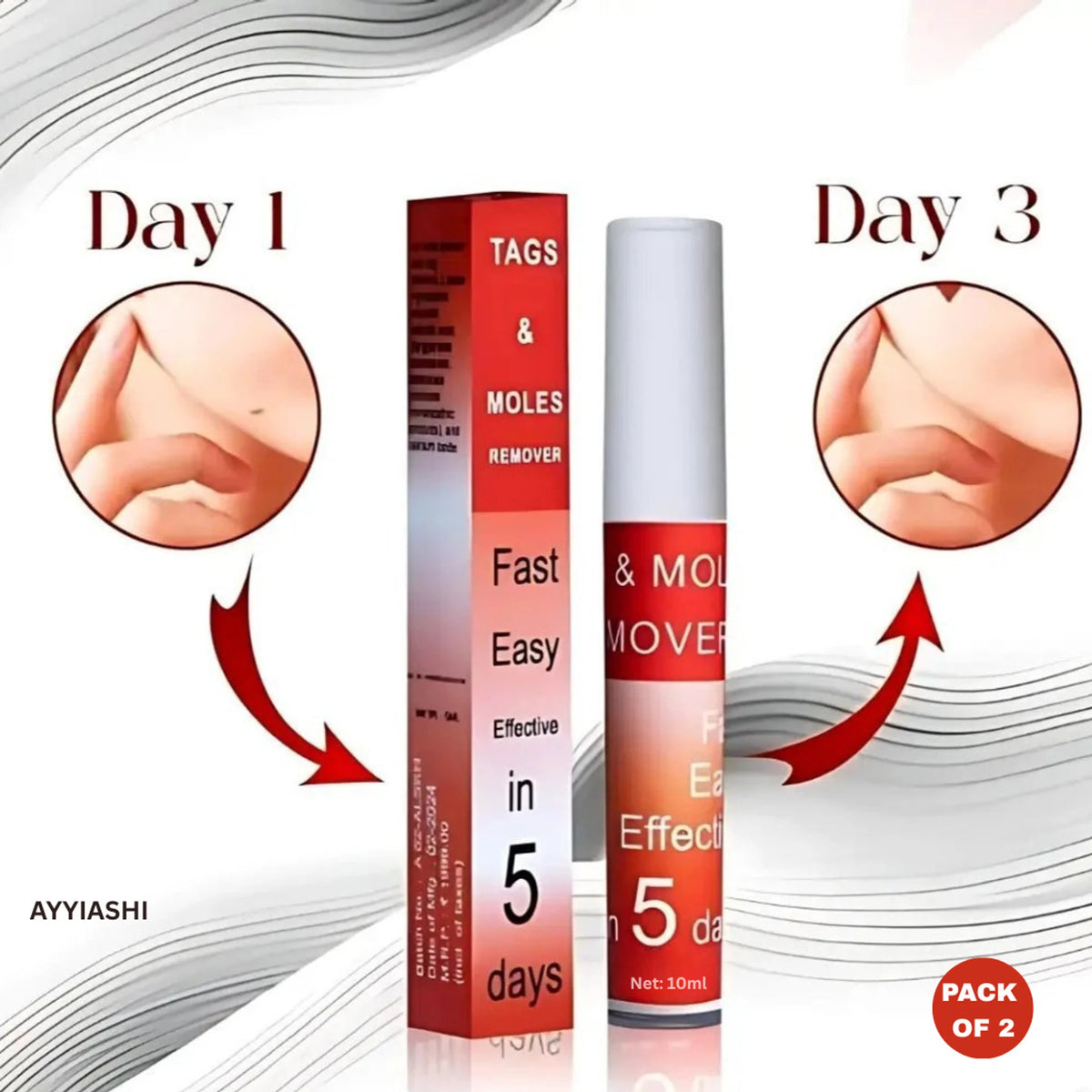 ✨ [Tags & Moles Remover 5ml - Pack of 2] 🌿💧✨