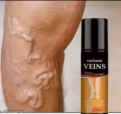 🩺 ~ Varicose Veins Health Care Spray 50ml (Pack of 2) ~ 🌿
