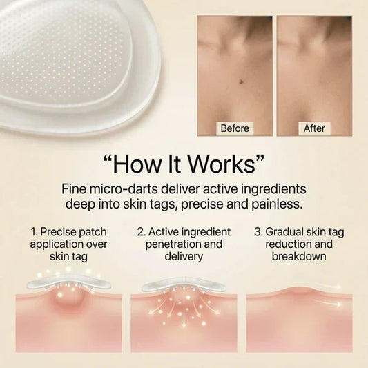 🔥 [BUY 1 GET 1 FREE] DermaSmooth™ Instant Skin Tag & Mole Removal Cream ✨ 100% Effective & Painless 🌿 (Pack of 2)